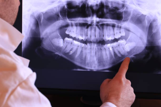 Best Emergency Treatment for Dental Infections or Abscesses in Hummelstown, PA